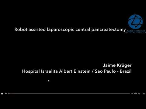 VID06: Minimal Invasive Pancreas Surgery