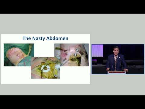 SYM06 Prevent and Manage Complications after Pancreas Resection