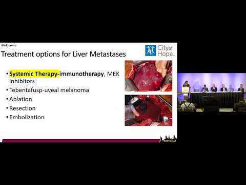 SYM07: Contemporary Management of NNECR Liver Metastasis