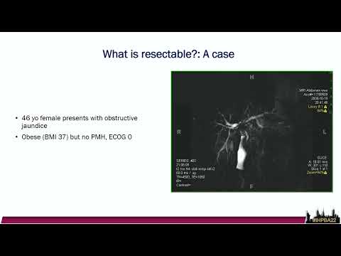 SYM09 IHPBA Meets ASTS Transplant for Cholangiocarcinoma