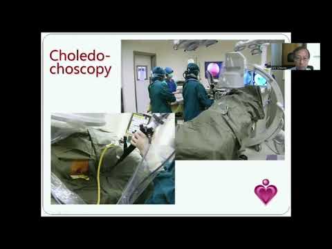 SYM10 Surgical Management of Benign Biliary Diseases