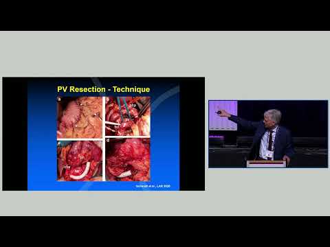 DEB01: Open vs Robotic; PDAC with Vascular Involvement