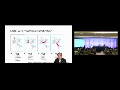 DEB09: HCC Macrovascular Invasion Resection