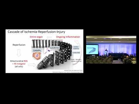 KN03: An Ideal Liver Graft Machine Profusion