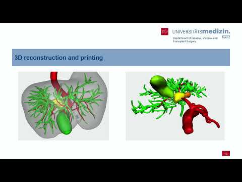US04: Update on Liver Imaging and Printing
